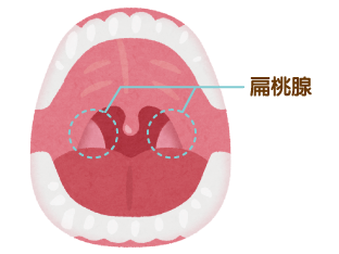 のど くび の病気 京都市北区 北大路堀川 バス停前 やまもと耳鼻咽喉科クリニック